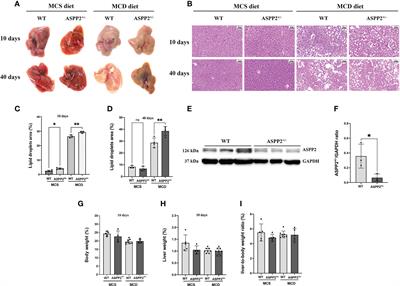 Dysregulated hepatic lipid metabolism and gut microbiota associated with early-stage NAFLD in ASPP2-deficiency mice